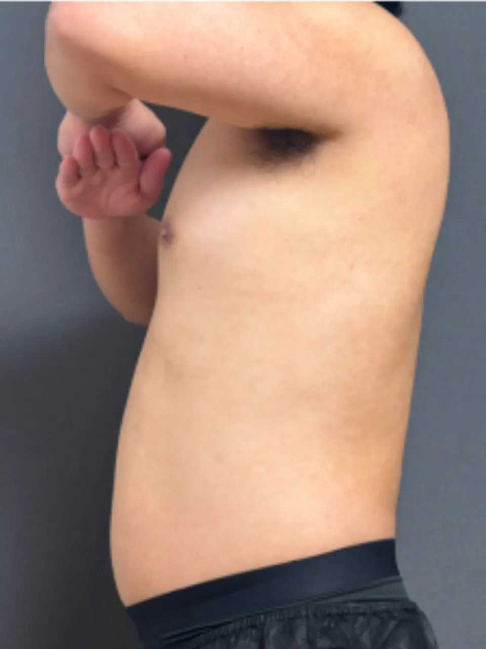 治療後のイメージ