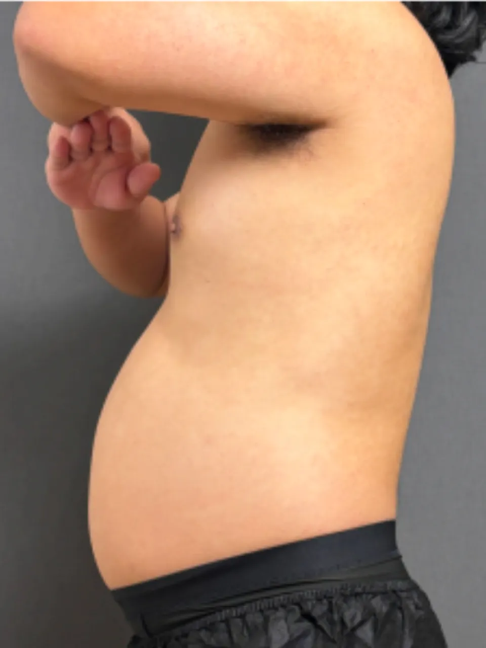 治療前のイメージ