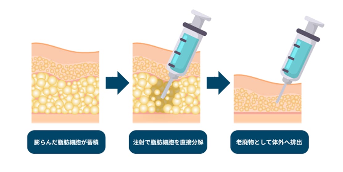 なぜ注射で「理想のボディライン」が手に入るのか