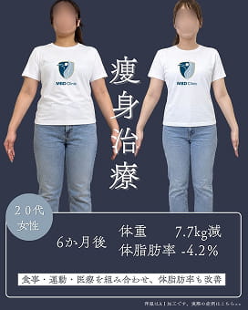 痩身治療