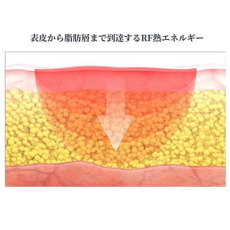 運動では動かしにくい細かな筋肉まで、深部の脂肪層まで