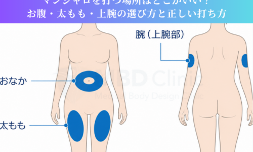 マンジャロを打つ場所