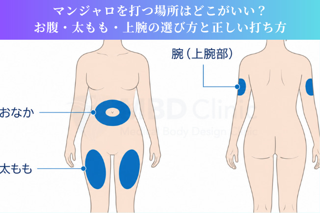 マンジャロを打つ場所