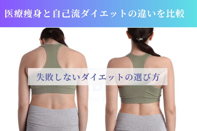 医療痩身と自己流ダイエットの違い