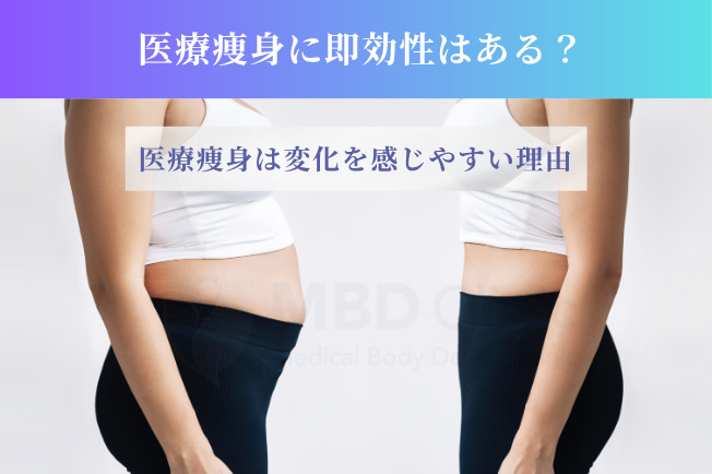 医療痩身に即効性はある