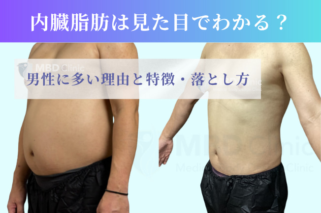 内臓脂肪は見た目でわかる?
